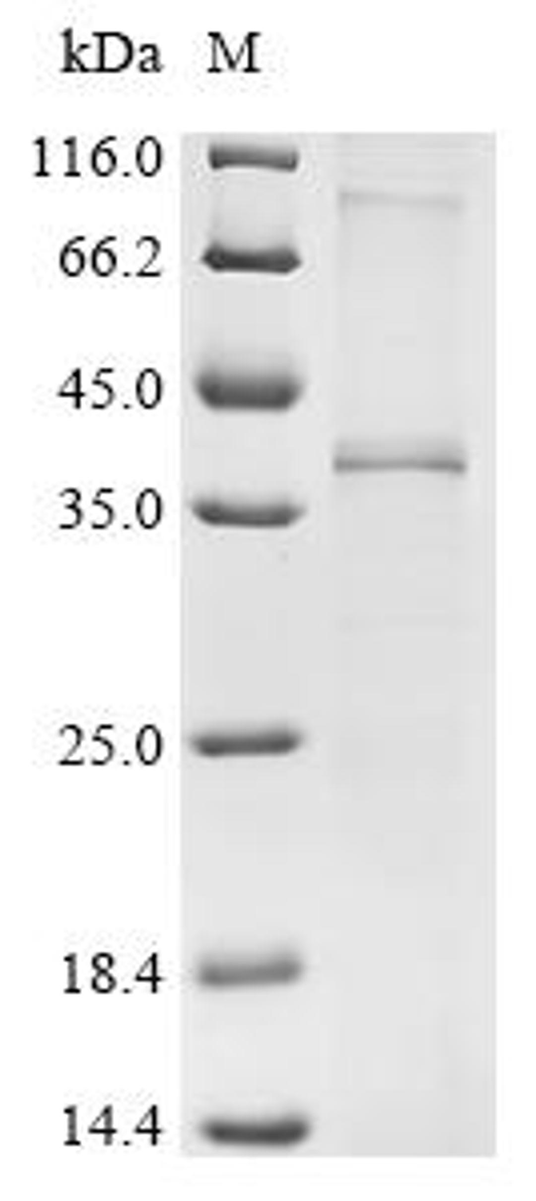 (Tris-Glycine gel) Discontinuous SDS-PAGE (reduced) with 5% enrichment gel and 15% separation gel.