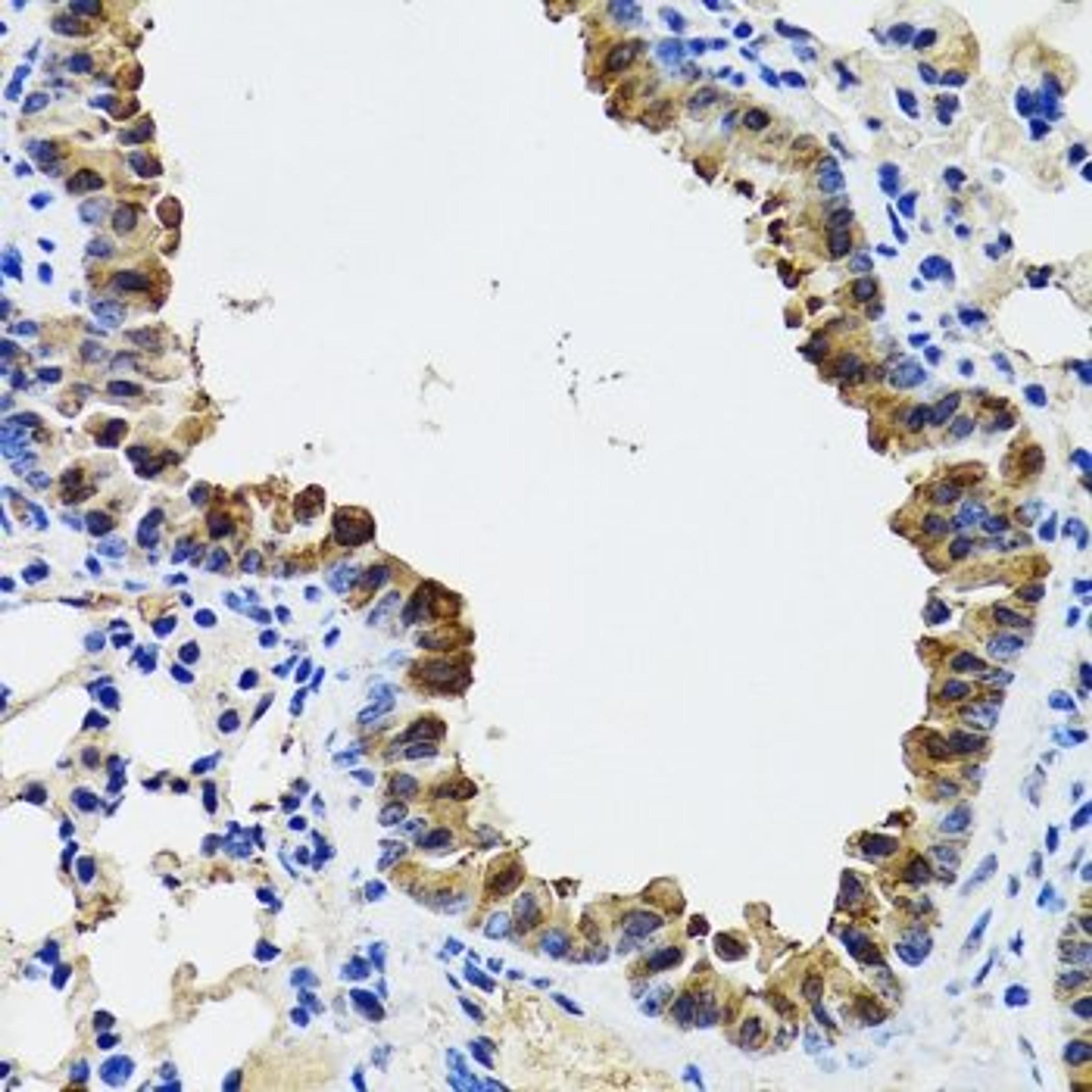 Immunohistochemistry of paraffin-embedded mouse lung tissue using ESD antibody