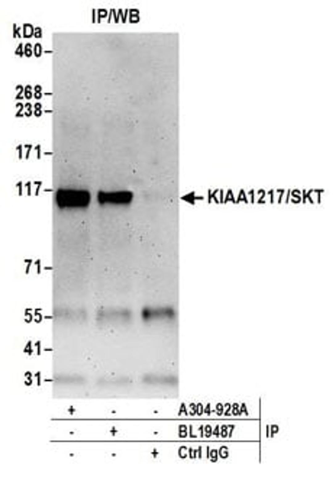 Detection of human KIAA1217/SKT by western blot of immunoprecipitates.