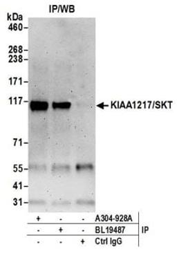 Detection of human KIAA1217/SKT by western blot of immunoprecipitates.