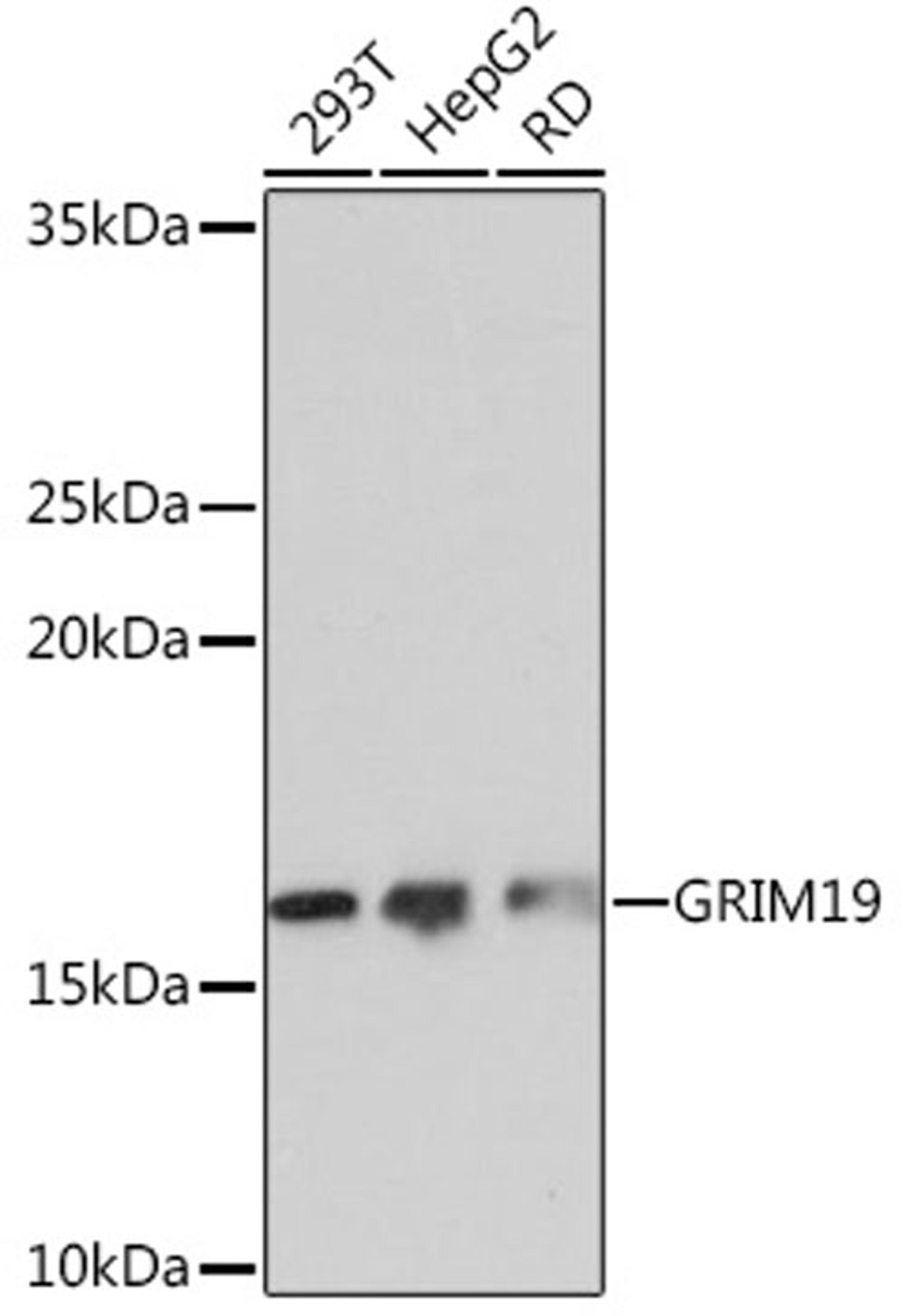 Western blot - GRIM19 Rabbit mAb (A3782)