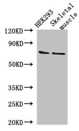 Western blot analysis of HEK293 whole cell lysate(lane 1), Mouse skletal muscle tissue(lane 2) using EFCAB7 antibody