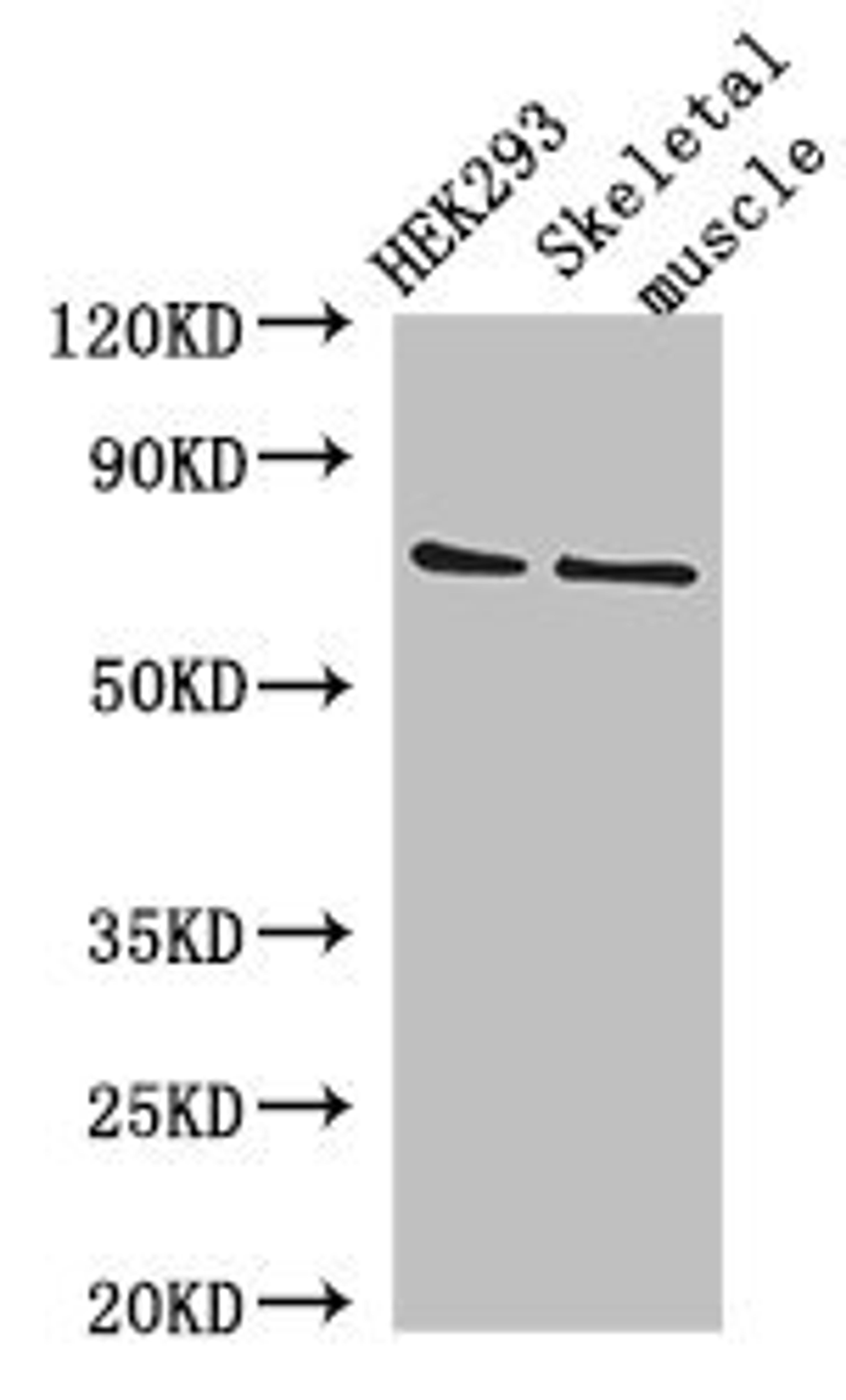 Western blot analysis of HEK293 whole cell lysate(lane 1), Mouse skletal muscle tissue(lane 2) using EFCAB7 antibody