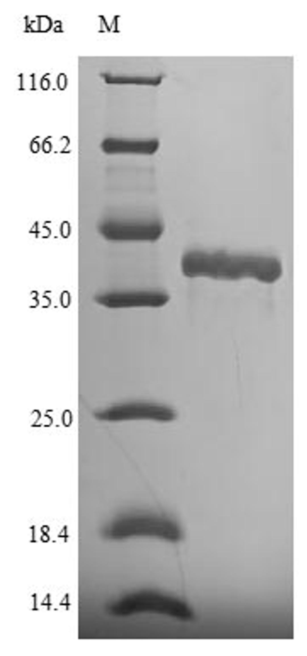 (Tris-Glycine gel) Discontinuous SDS-PAGE (reduced) with 5% enrichment gel and 15% separation gel.