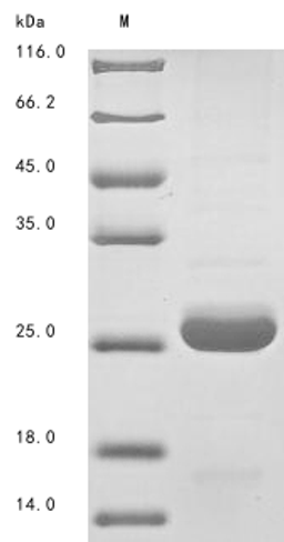 (Tris-Glycine gel) Discontinuous SDS-PAGE (reduced) with 5% enrichment gel and 15% separation gel.