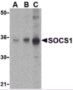 Western blot analysis of SOCS1 in Human spleen cell lysate with SOCS1 antibody at (A) 1, (B) 2 and (C) 4 &#956;g/mL.