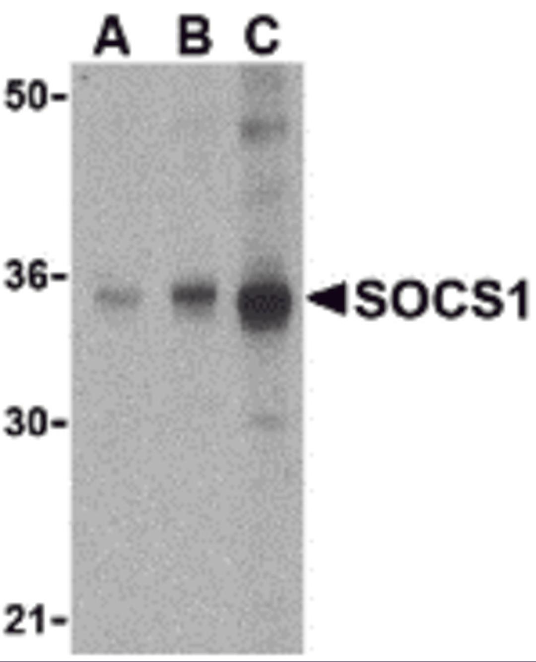 Western blot analysis of SOCS1 in Human spleen cell lysate with SOCS1 antibody at (A) 1, (B) 2 and (C) 4 μg/mL.