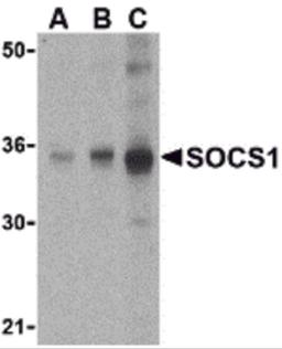 Western blot analysis of SOCS1 in Human spleen cell lysate with SOCS1 antibody at (A) 1, (B) 2 and (C) 4 μg/mL.