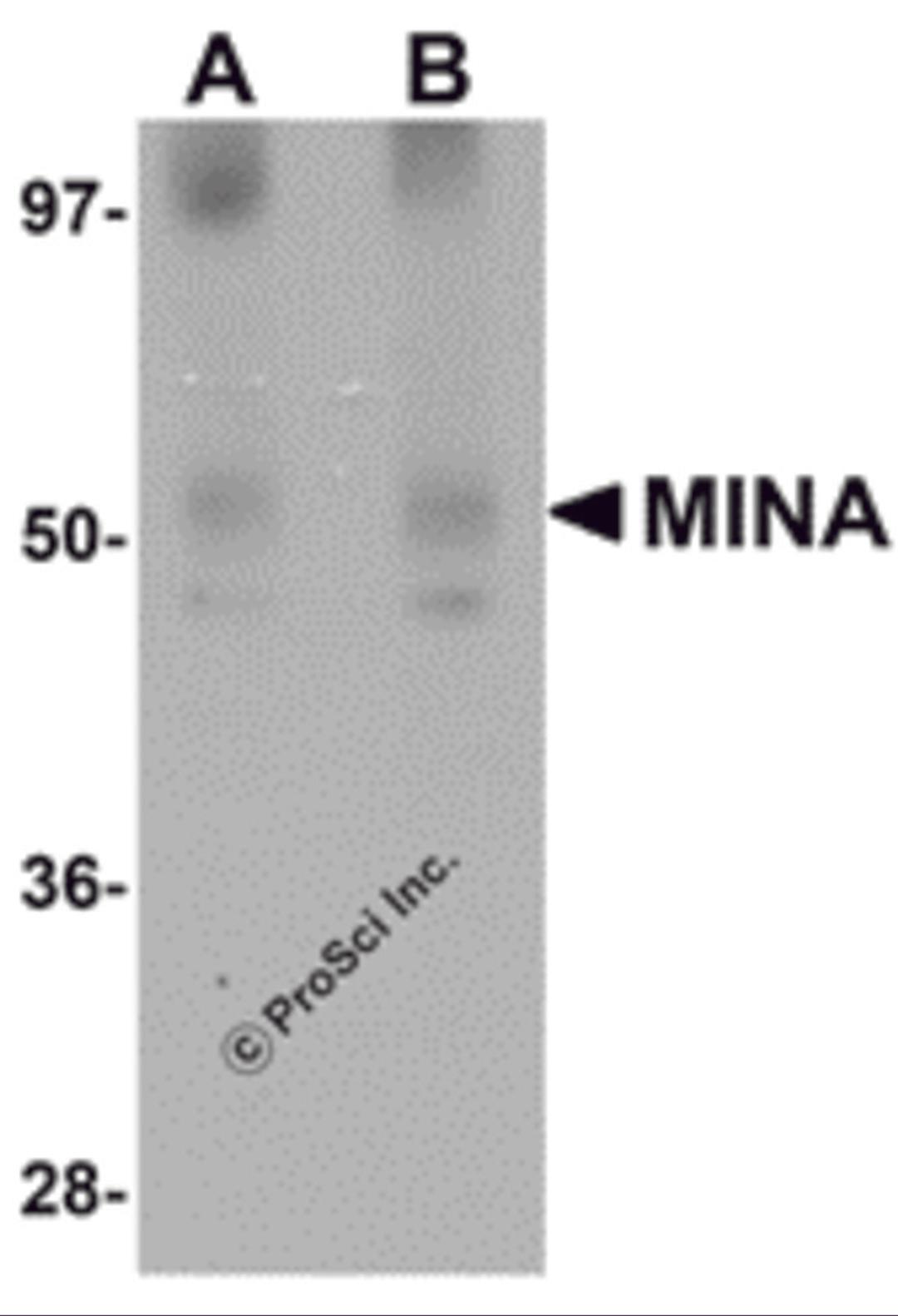 Western blot analysis of MINA in human heart tissue lysate with MINA antibody at (A) 1 and (B) 2 μg/mL.