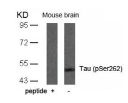 Western blot analysis of lysed extracts from mouse brain tissue using Tau (Phospho-Ser262).