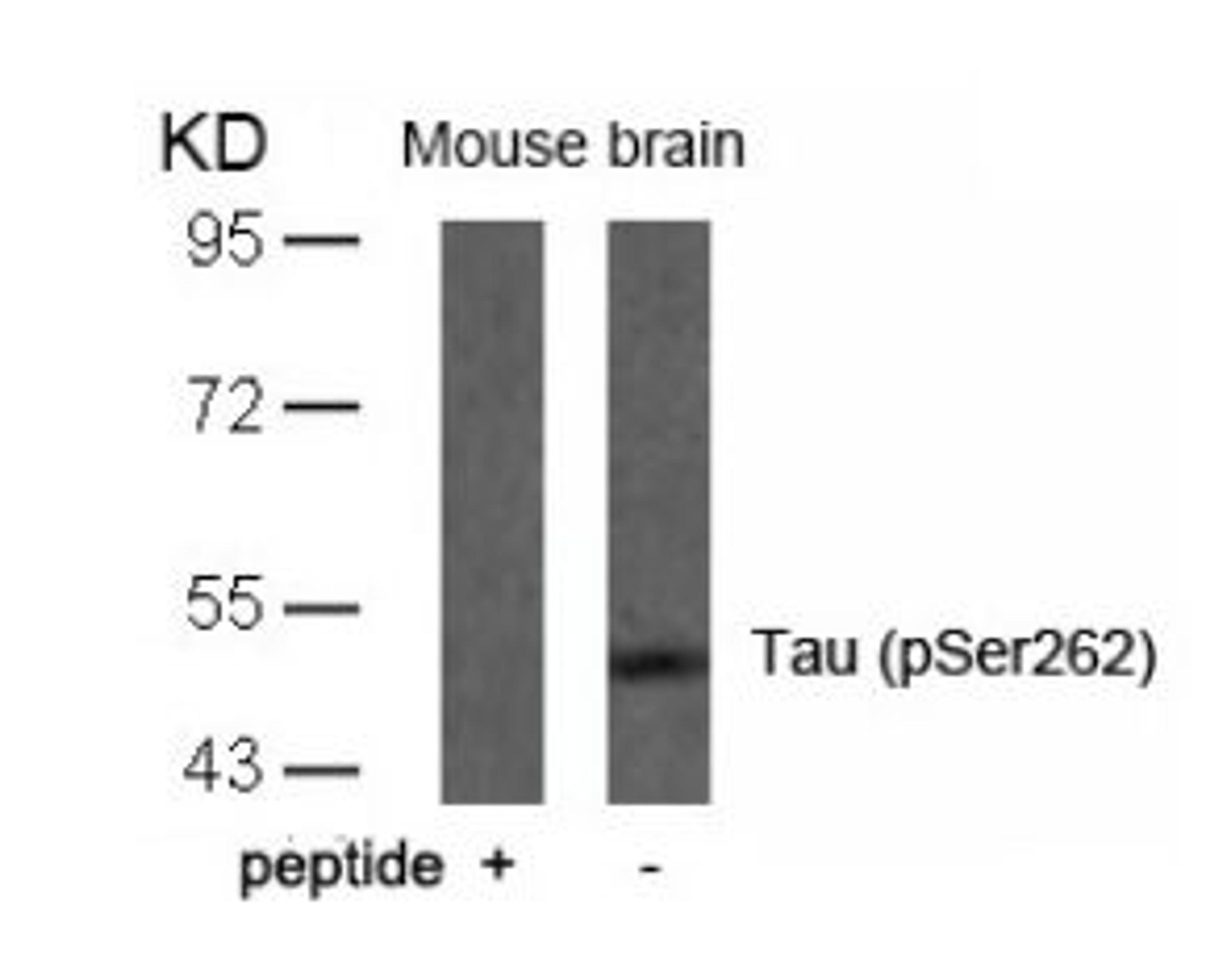 Western blot analysis of lysed extracts from mouse brain tissue using Tau (Phospho-Ser262).