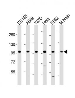 Western Blot at 1:1000-1:2000 dilution Lane 1: DU145 whole cell lysate Lane 2: A549 whole cell lysate Lane 3: T47D whole cell lysate Lane 4: Hela whole cell lysate Lane 5: K562 whole cell lysate Lane 6: M.brain whole lysate Lysates/proteins at 20 ug per l