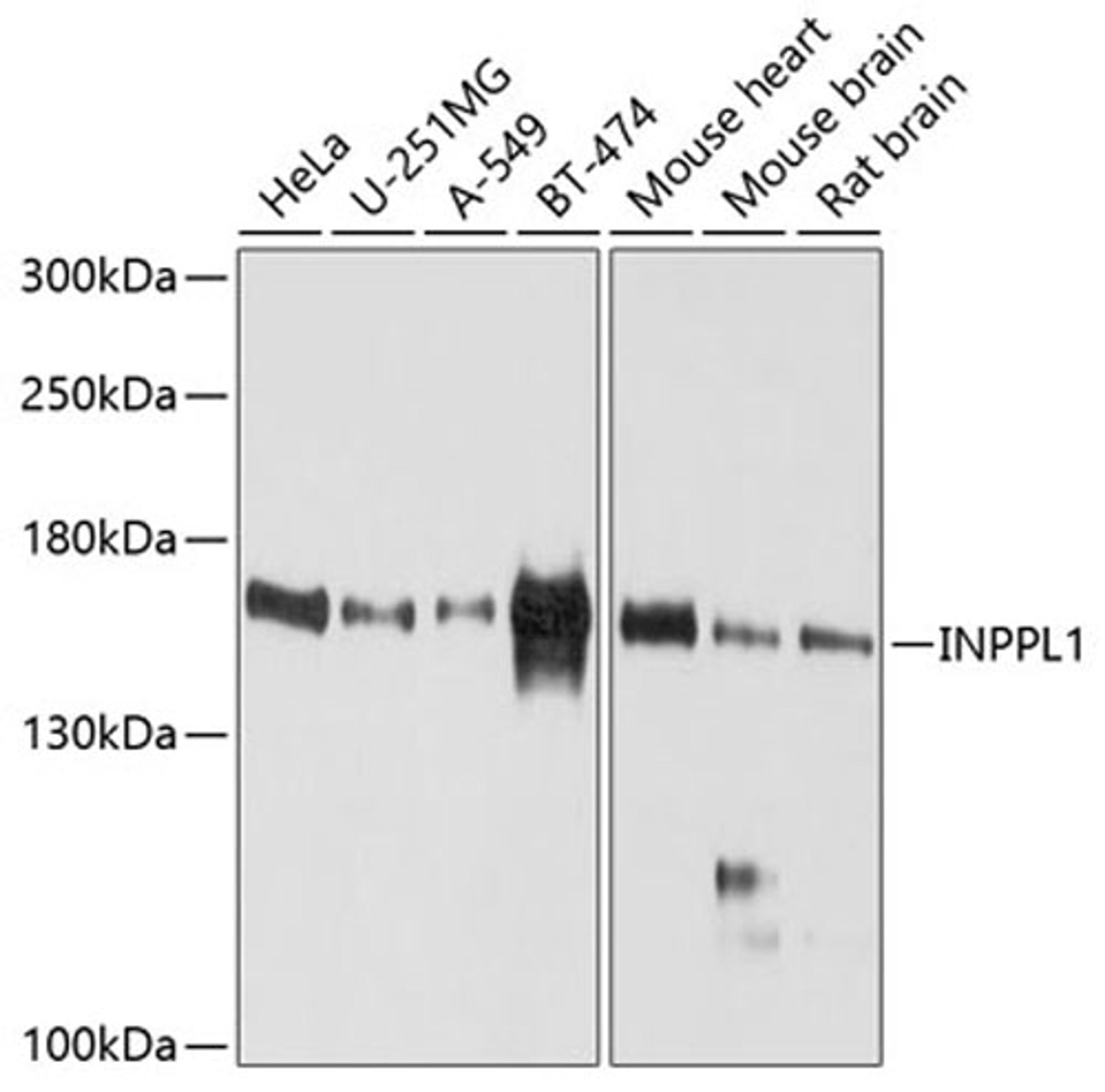 Western blot - INPPL1 antibody (A10115)