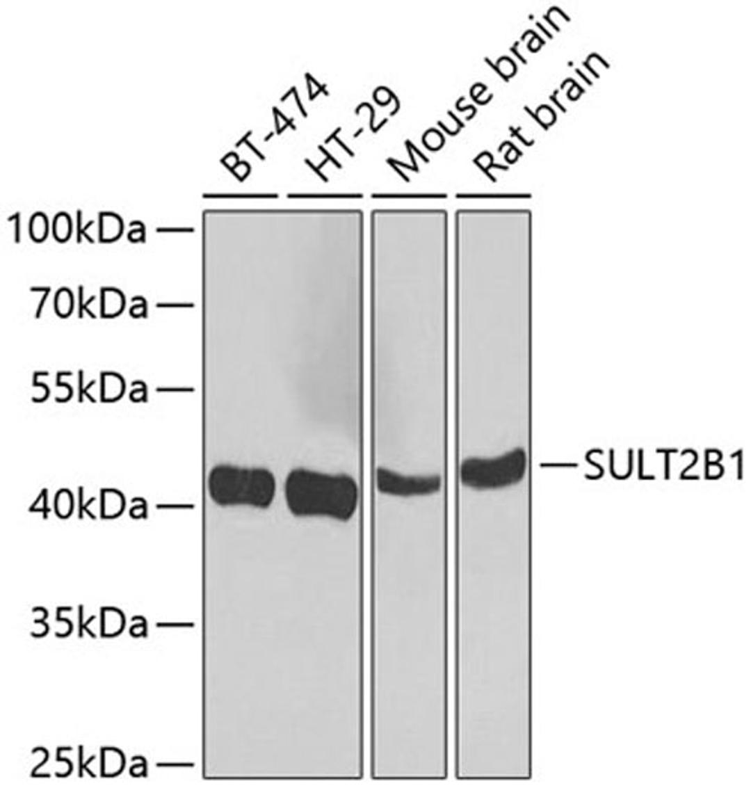 Western blot - SULT2B1 antibody (A7736)