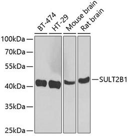 Western blot - SULT2B1 antibody (A7736)