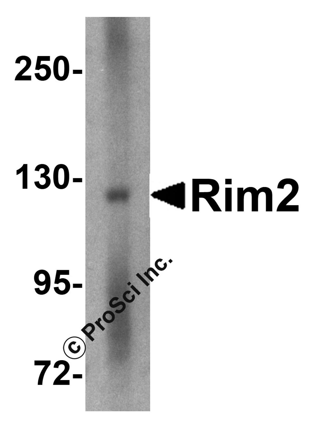 Western blot analysis of Rim2 in human brain tissue lysate with Rim2 antibody at 1 &#956;g/mL. 