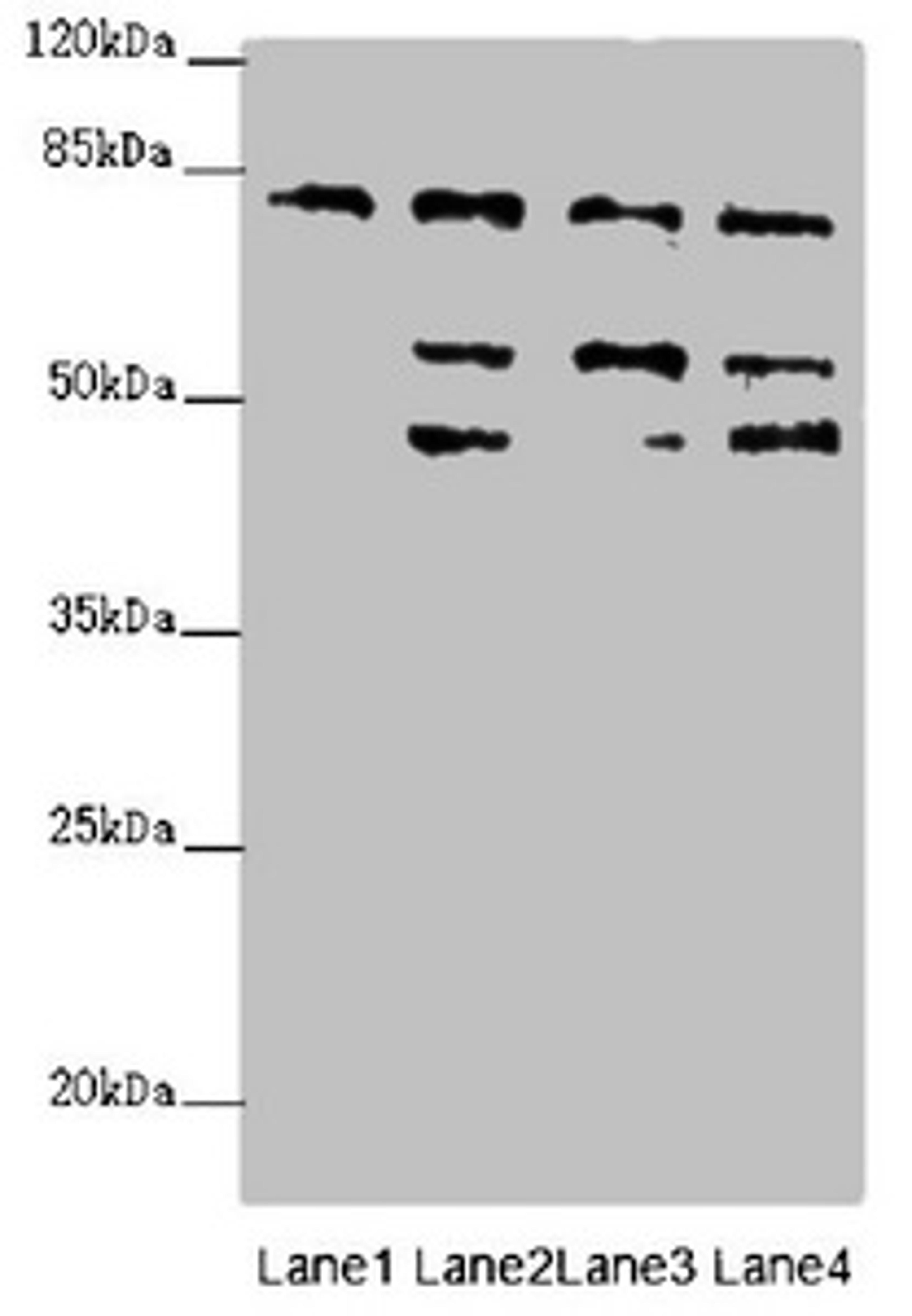 Western blot. All lanes: ZFYVE1 antibody at 6.89ug/ml. Lane 1: Hela whole cell lysate. Lane 2: 293T whole cell lysate. Lane 3: Mouse liver tissue. Lane 4: Mouse kidney tissue. Secondary. Goat polyclonal to rabbit IgG at 1/10000 dilution. Predicted band size: 88, 41, 86 kDa. Observed band size: 81, 54, 47 kDa. 