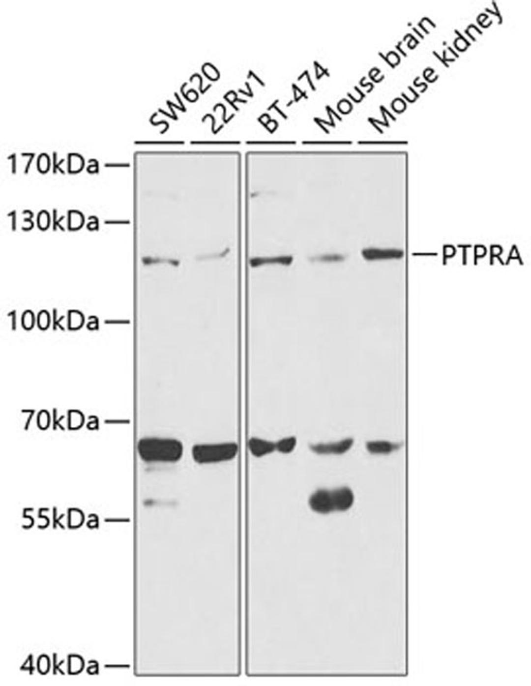 Western blot - PTPRA antibody (A1976)