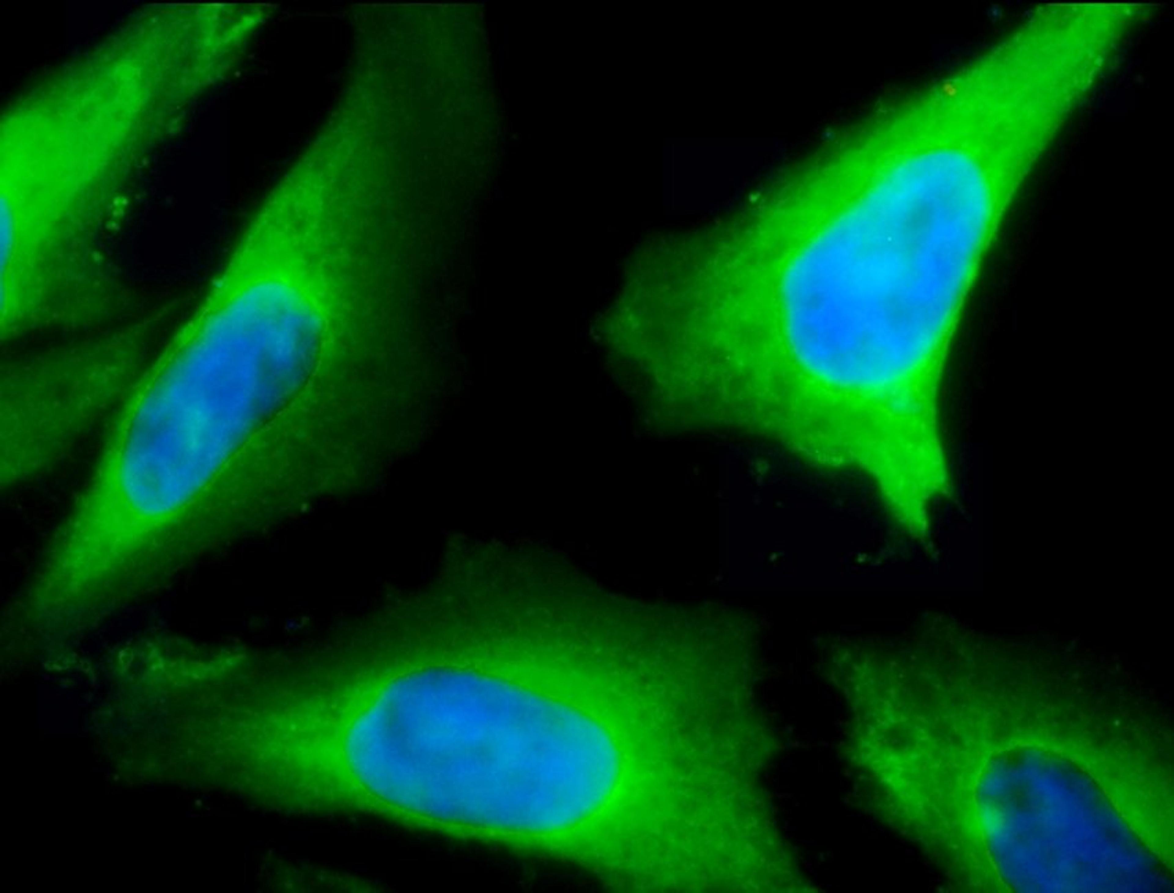 Immunofluorescence analysis of heat shocked hela cells using Hsp40 antibody