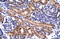 Antibody used in IHC on Human kidney.