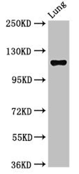 Western Blot. Positive WB detected in: Rat lung tissue. All lanes: MAP3K9 antibody at 2.7ug/ml. Secondary. Goat polyclonal to rabbit IgG at 1/50000 dilution. Predicted band size: 122, 124 kDa. Observed band size: 122 kDa. 
