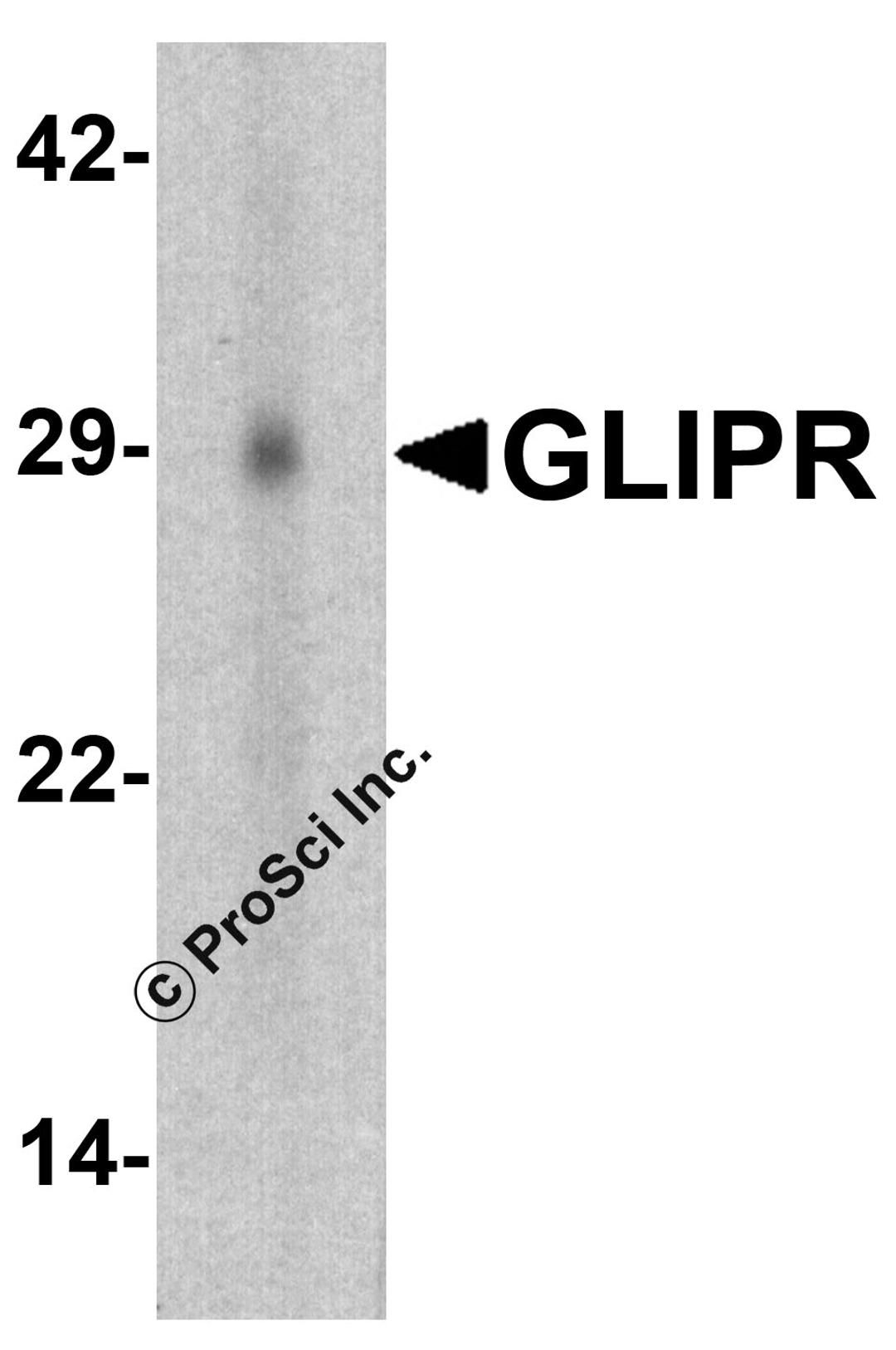 Western blot analysis of GLIPR1 in human small intestine tissue lysate with GLIPR1 antibody at 1 μg/ml.