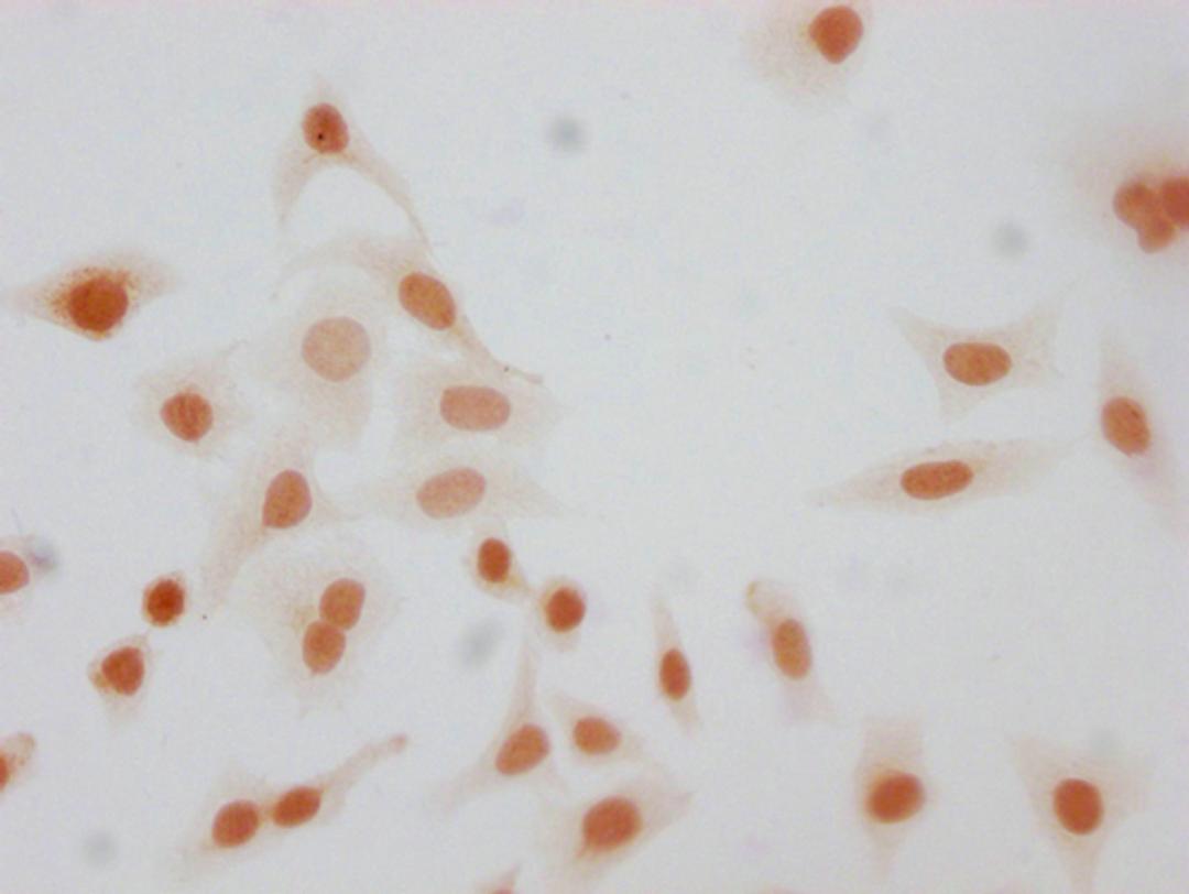Immunocytochemistry analysis of CSB-PA010380OA26phHU diluted at 1:10 and staining in Hela cells(treated with 50nM Calyculin A for 30min) performed on a Leica BondTM system. The cells were fixed in 4% formaldehyde, permeabilized using 0.2% Triton X-100 and blocked with 10% normal goat serum 30min at RT. Then primary antibody (1% BSA) was incubated at 4°C overnight. The primary is detected by a biotinylated secondary antibody and visualized using an HRP conjugated SP system.