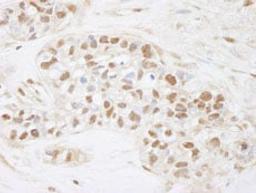 Detection of human CDC25c by immunohistochemistry.