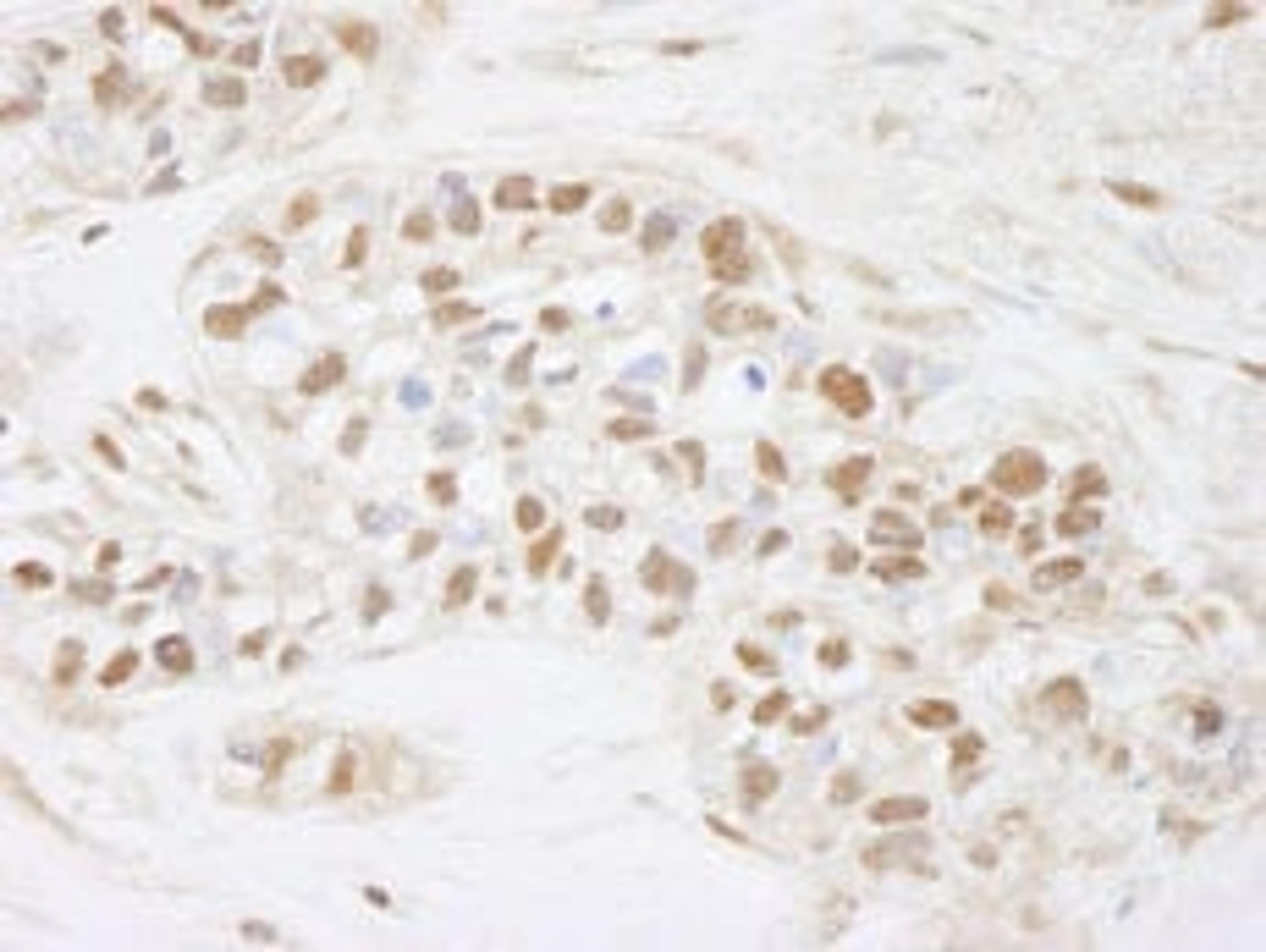 Detection of human CDC25c by immunohistochemistry.