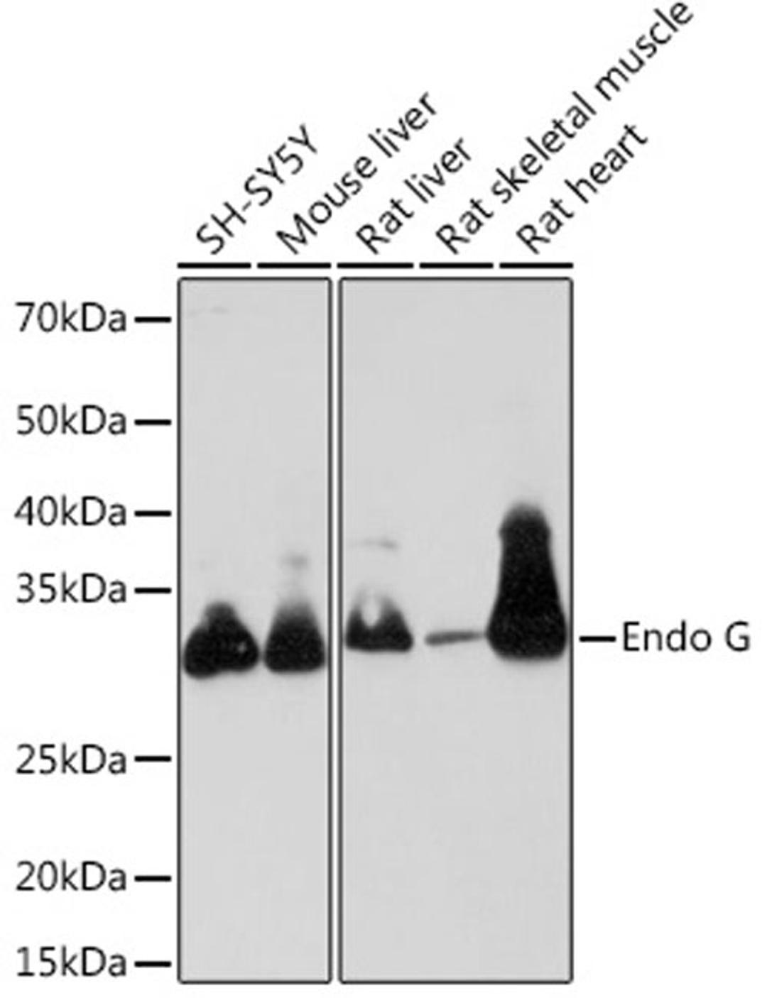 Western blot - Endo G Rabbit mAb (A8801)