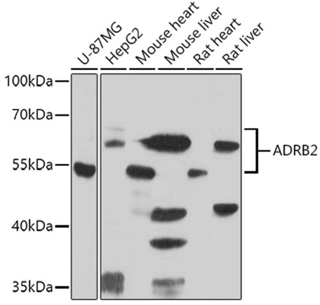 Western blot - ADRB2 antibody (A2048)