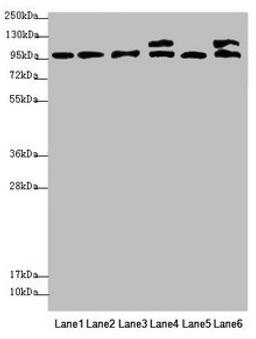 Western blot. All lanes: NAA25 antibody at 2.12µg/ml. Lane 1: Mouse liver tissue. Lane 2: Mouse kidney tissue. Lane 3: Hela whole cell lysate. Lane 4: 293T whole cell lysate. Lane 5: A549 whole cell lysate. Lane 6: HepG2 whole cell lysate. Secondary. Goat polyclonal to rabbit IgG at 1/10000 dilution. Predicted band size: 113, 100 kDa. Observed band size: 113, 100 kDa