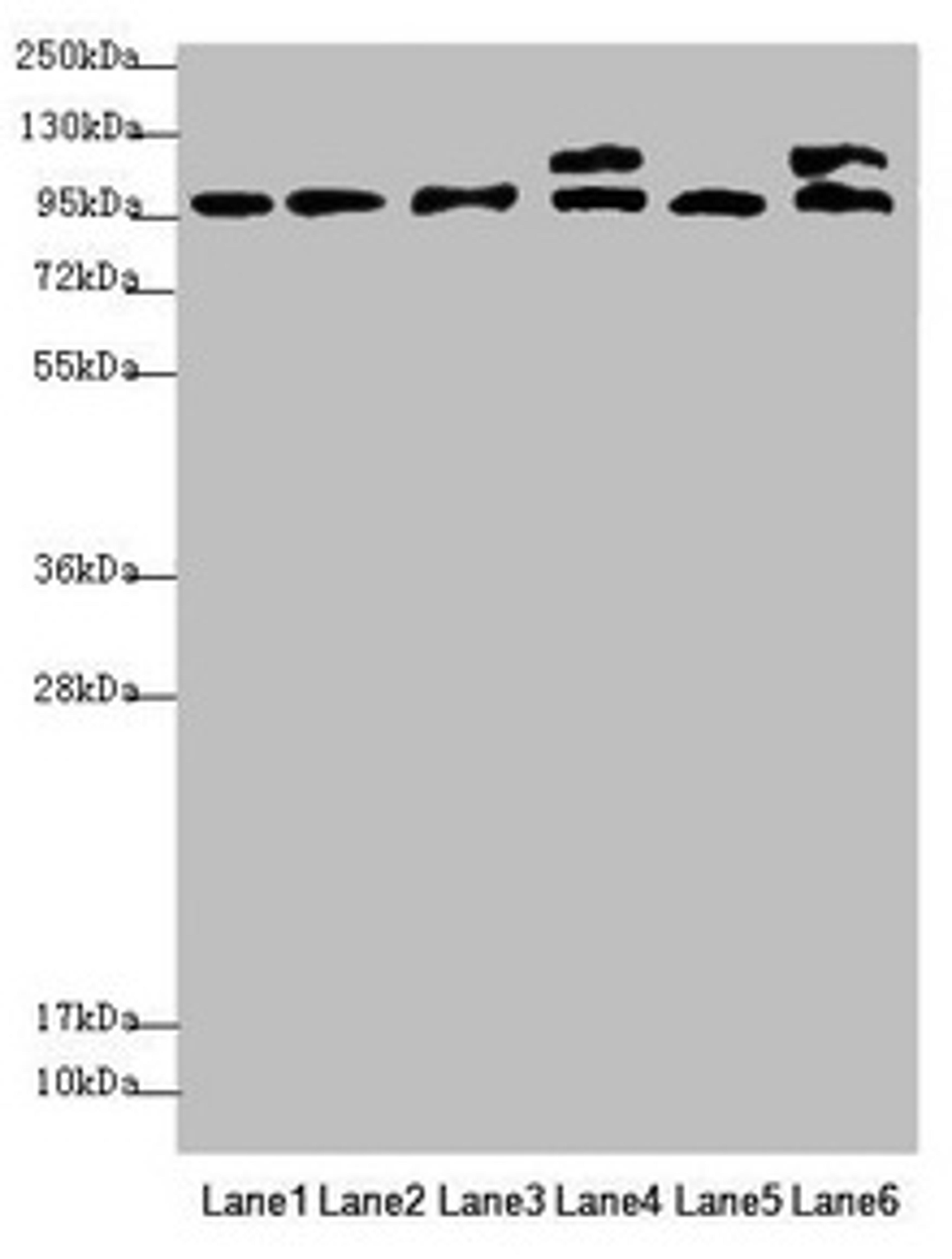 Western blot. All lanes: NAA25 antibody at 2.12µg/ml. Lane 1: Mouse liver tissue. Lane 2: Mouse kidney tissue. Lane 3: Hela whole cell lysate. Lane 4: 293T whole cell lysate. Lane 5: A549 whole cell lysate. Lane 6: HepG2 whole cell lysate. Secondary. Goat polyclonal to rabbit IgG at 1/10000 dilution. Predicted band size: 113, 100 kDa. Observed band size: 113, 100 kDa