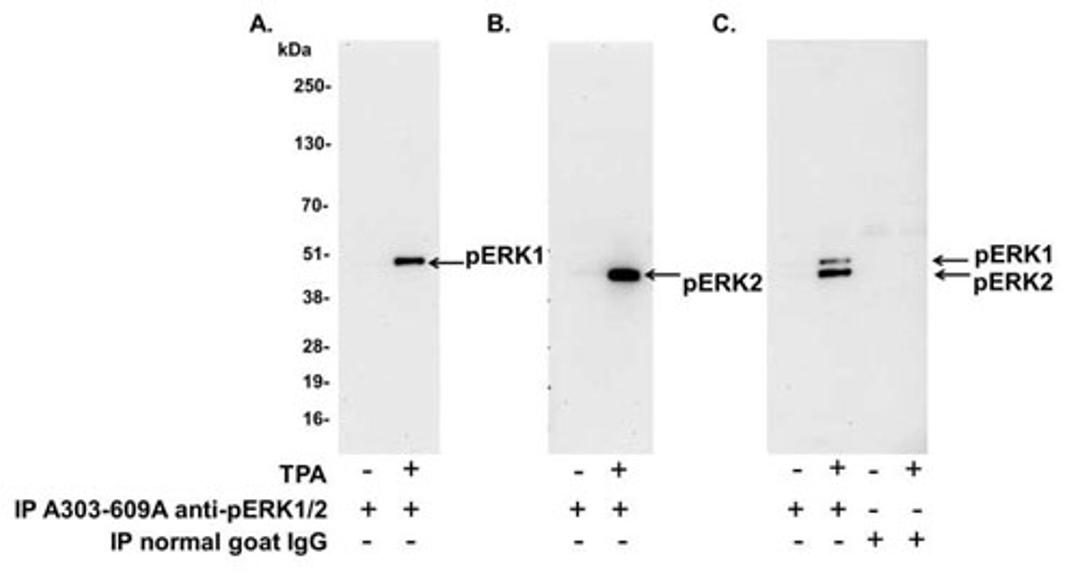 Detection of human Phospho-ERK1 and ERK2 by IP (IP).