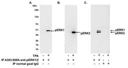 Detection of human Phospho-ERK1 and ERK2 by IP (IP).