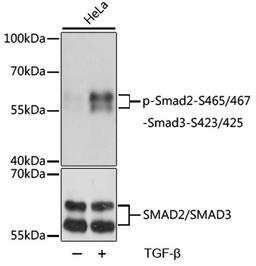 Western blot - Phospho-Smad2-S465/467/-Smad3-S423/425 pAb (AP0548)