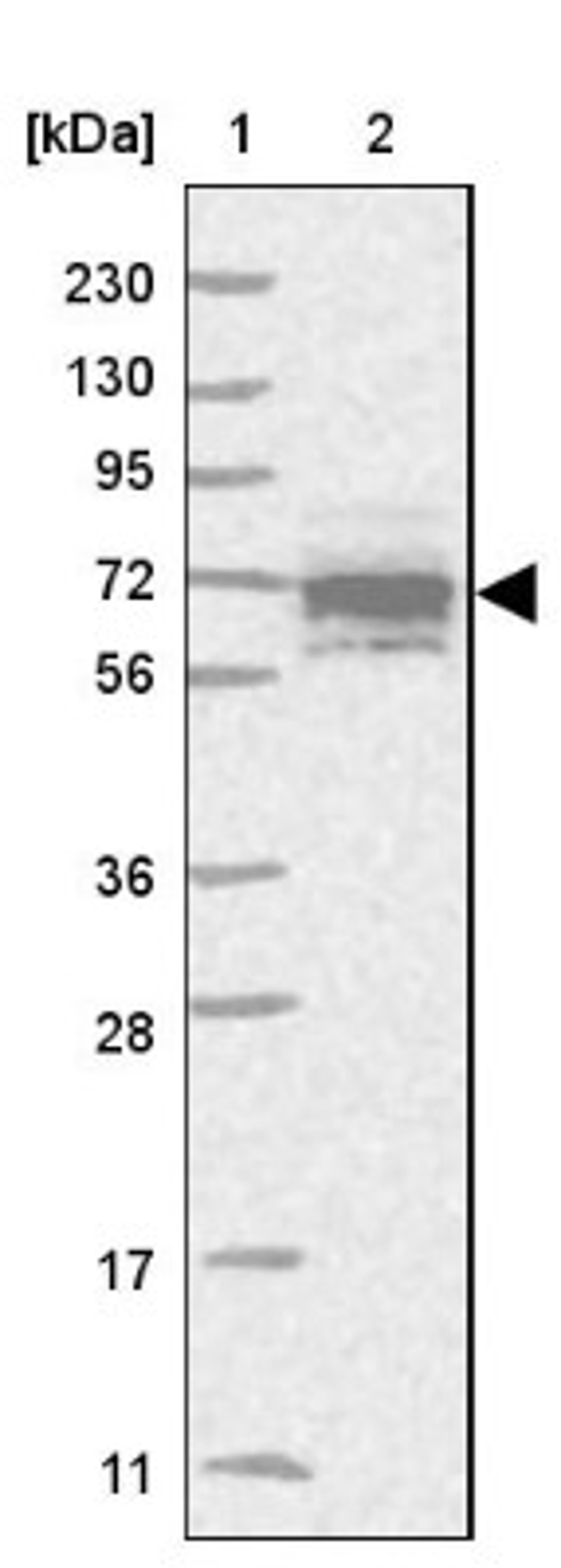 Western Blot: C17orf104 Antibody [NBP1-83495] - Lane 1: Marker [kDa] 230, 130, 95, 72, 56, 36, 28, 17, 11<br/>Lane 2: Human cell line RT-4