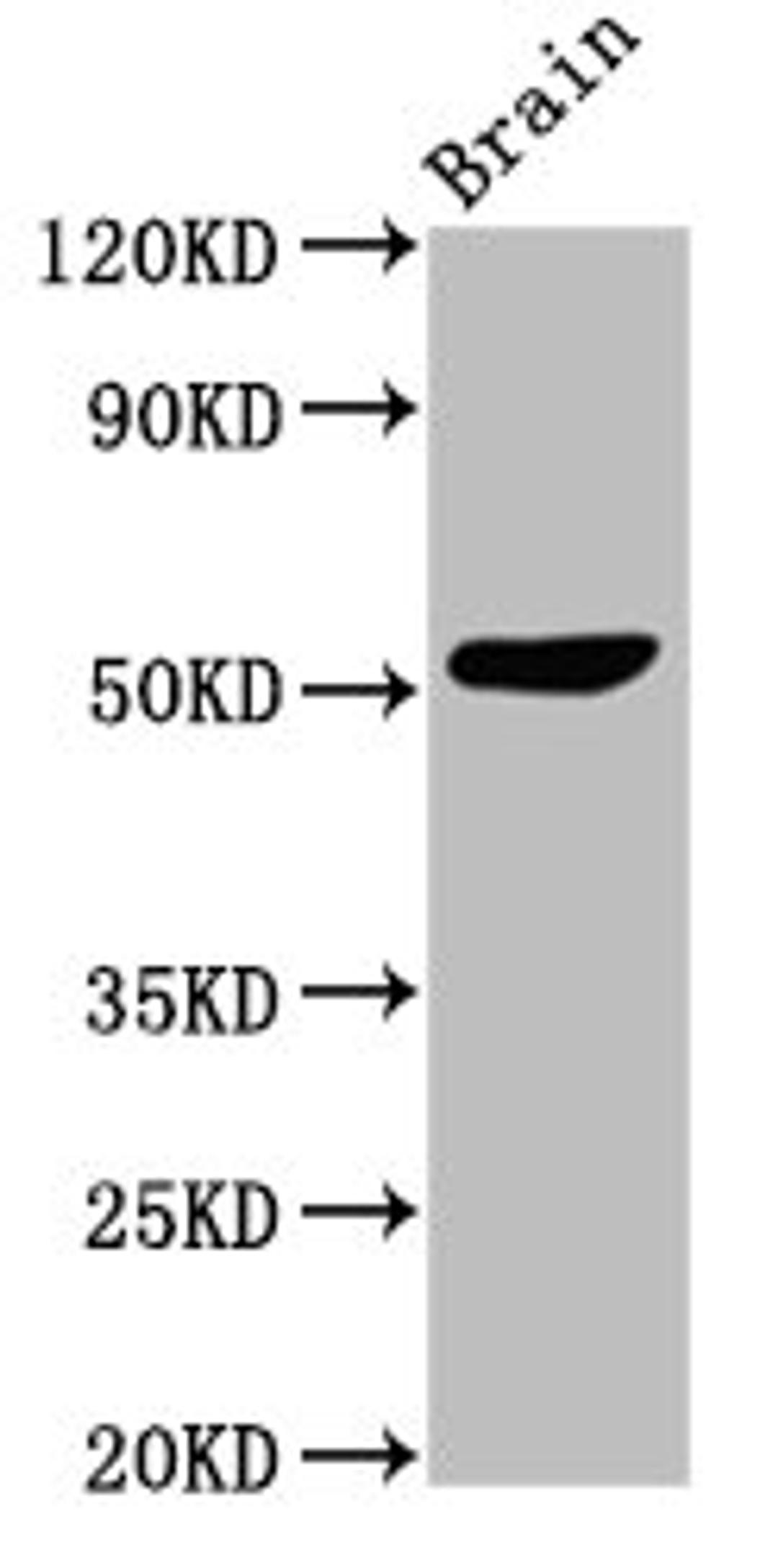 Western Blot. Positive WB detected in: Mouse brain tissue. All lanes: SLC30A10 antibody at 3ug/ml. Secondary. Goat polyclonal to rabbit IgG at 1/50000 dilution. Predicted band size: 53, 27, 25 kDa. Observed band size: 53 kDa. 
