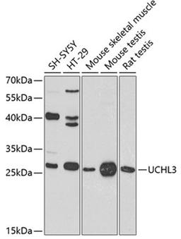 Western blot - UCHL3 antibody (A8156)