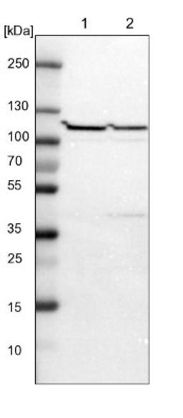 Western Blot: USP4 Antibody [NBP1-86876] - Lane 1: NIH-3T3 cell lysate (Mouse embryonic fibroblast cells)<br/>Lane 2: NBT-II cell lysate (Rat Wistar bladder tumour cells)