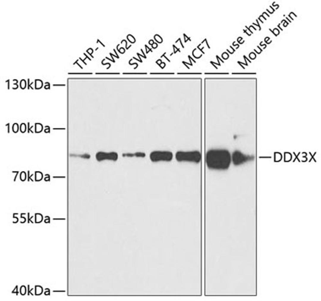 Western blot - DDX3X Antibody (A5637)