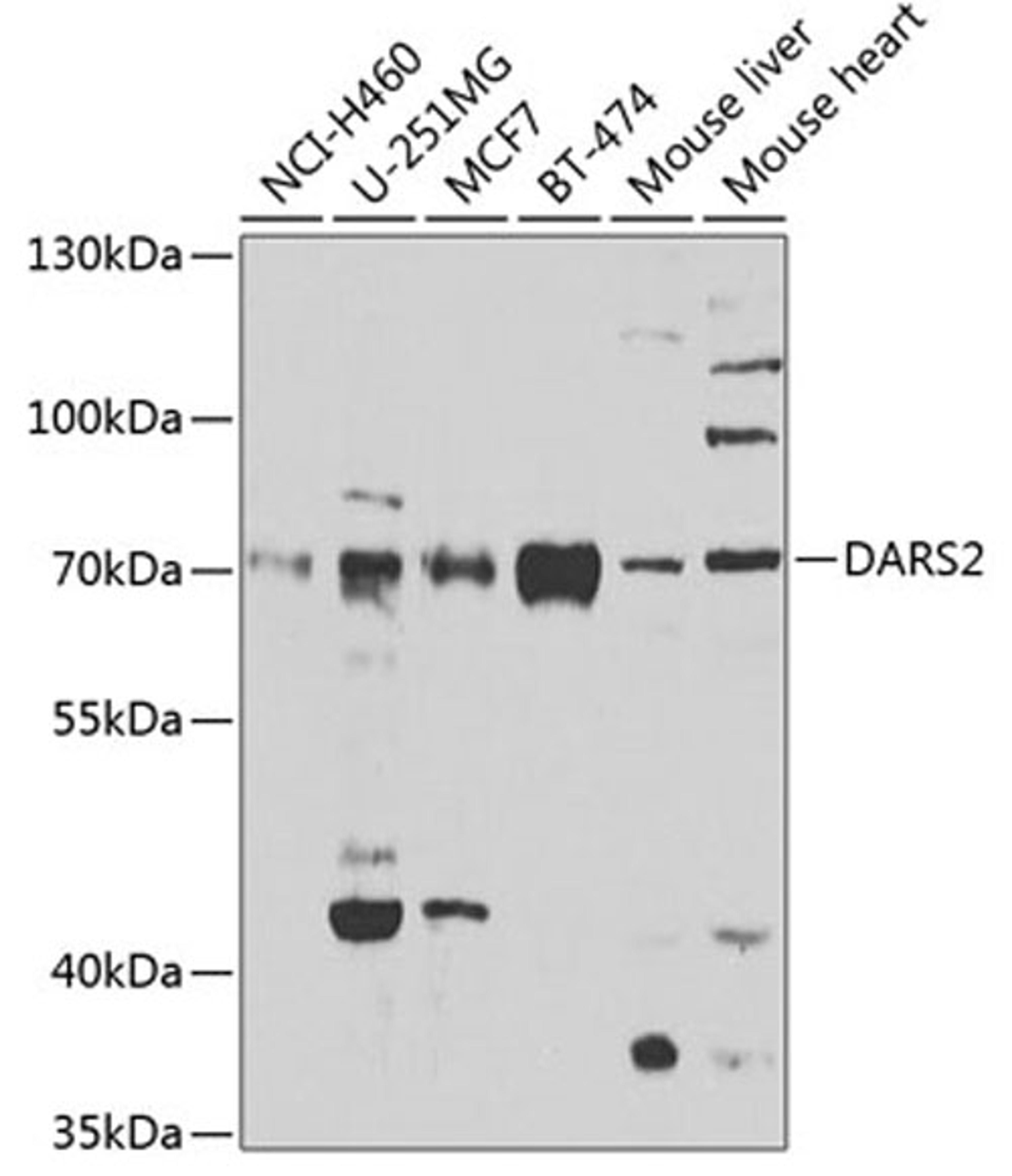 Western blot - DARS2 antibody (A7813)