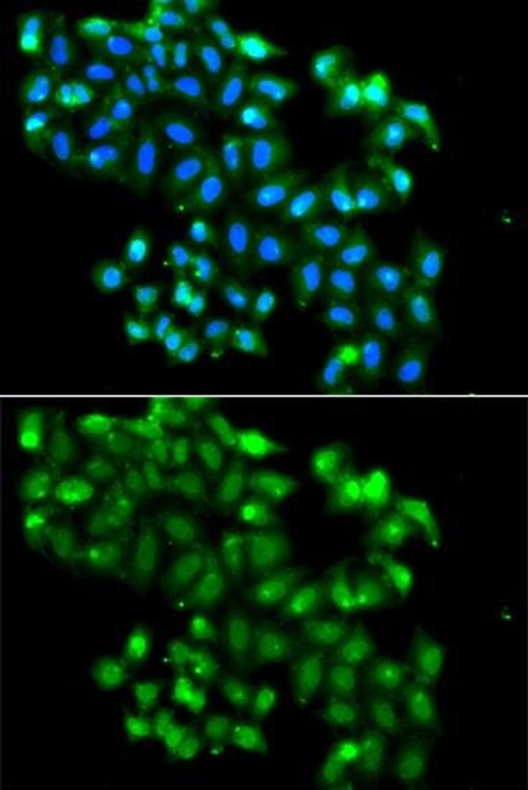 Immunofluorescence analysis of A549 cell using PHF11 antibody