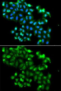 Immunofluorescence analysis of A549 cell using PHF11 antibody