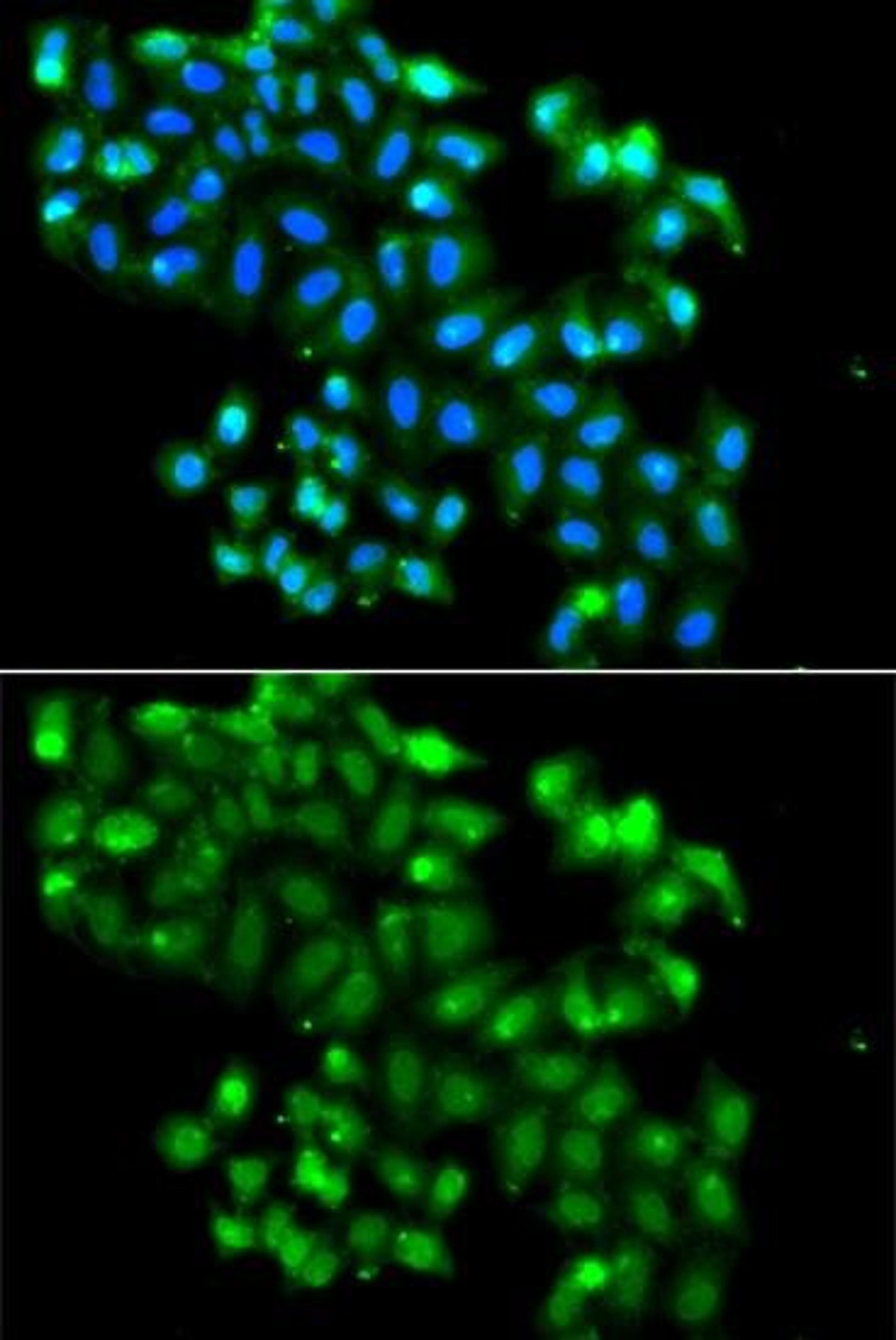 Immunofluorescence analysis of A549 cell using PHF11 antibody