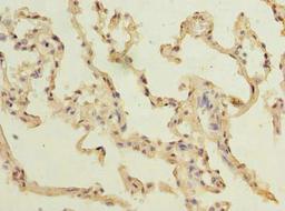 Immunohistochemistry of paraffin-embedded human lung tissue using CSB-PA023615LA01HU at dilution of 1:100