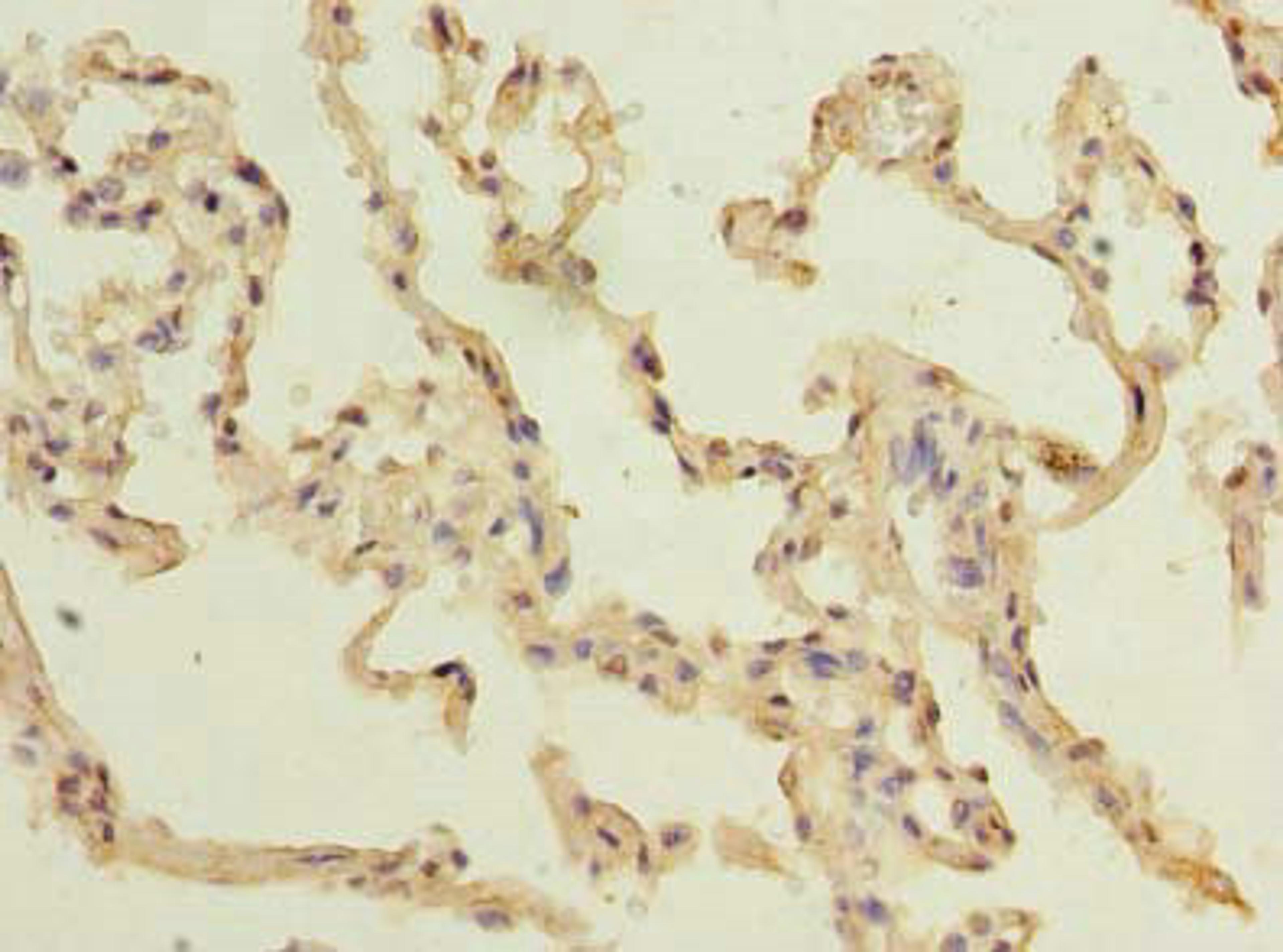 Immunohistochemistry of paraffin-embedded human lung tissue using CSB-PA023615LA01HU at dilution of 1:100