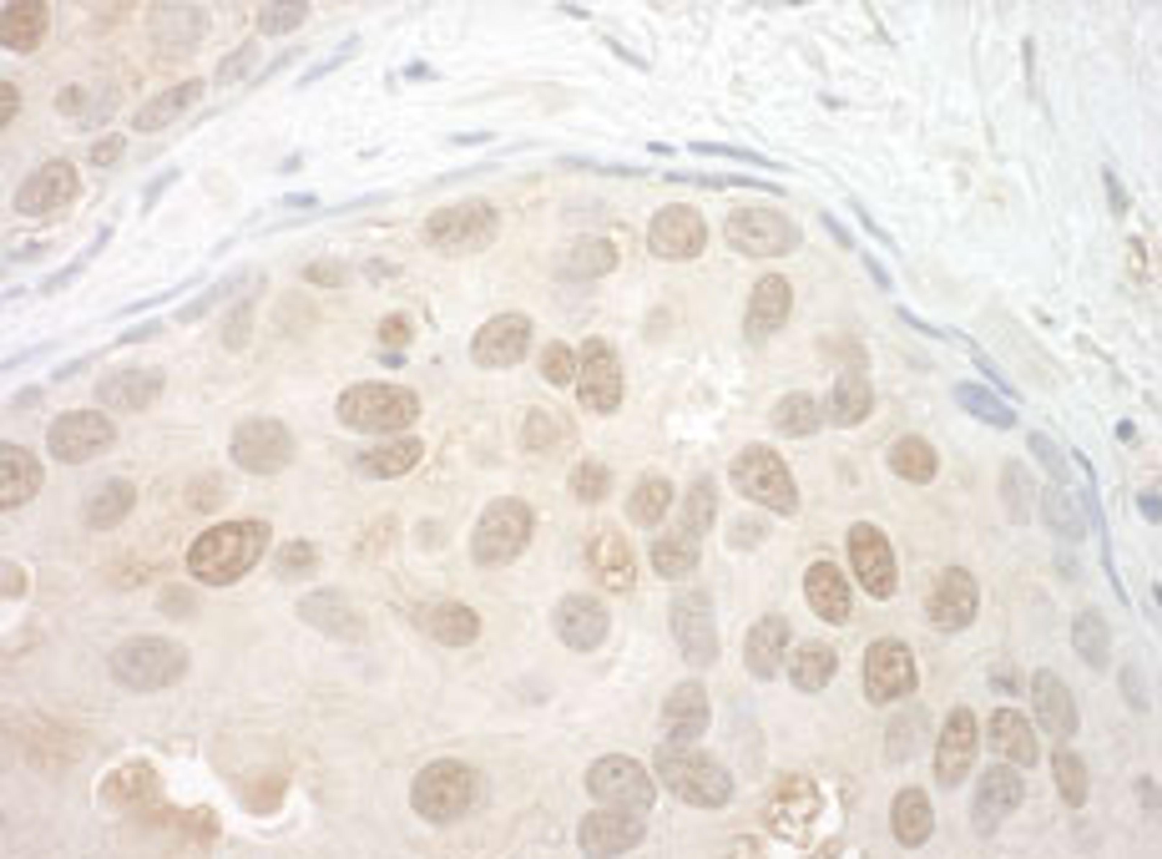 Detection of human ORC2 by immunohistochemistry.