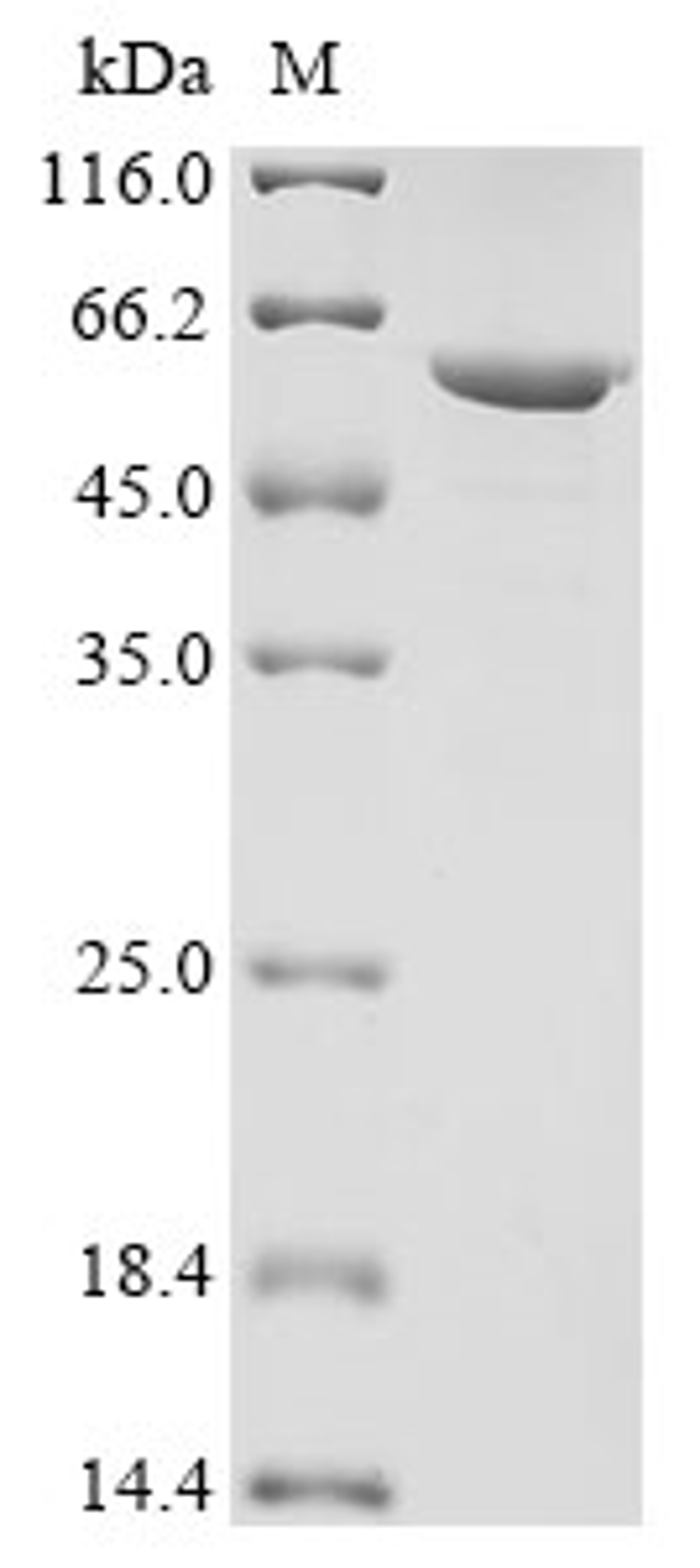 (Tris-Glycine gel) Discontinuous SDS-PAGE (reduced) with 5% enrichment gel and 15% separation gel.