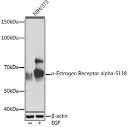 Western blot - Phospho-Estrogen Receptor alpha-S118 Rabbit mAb (AP1004)